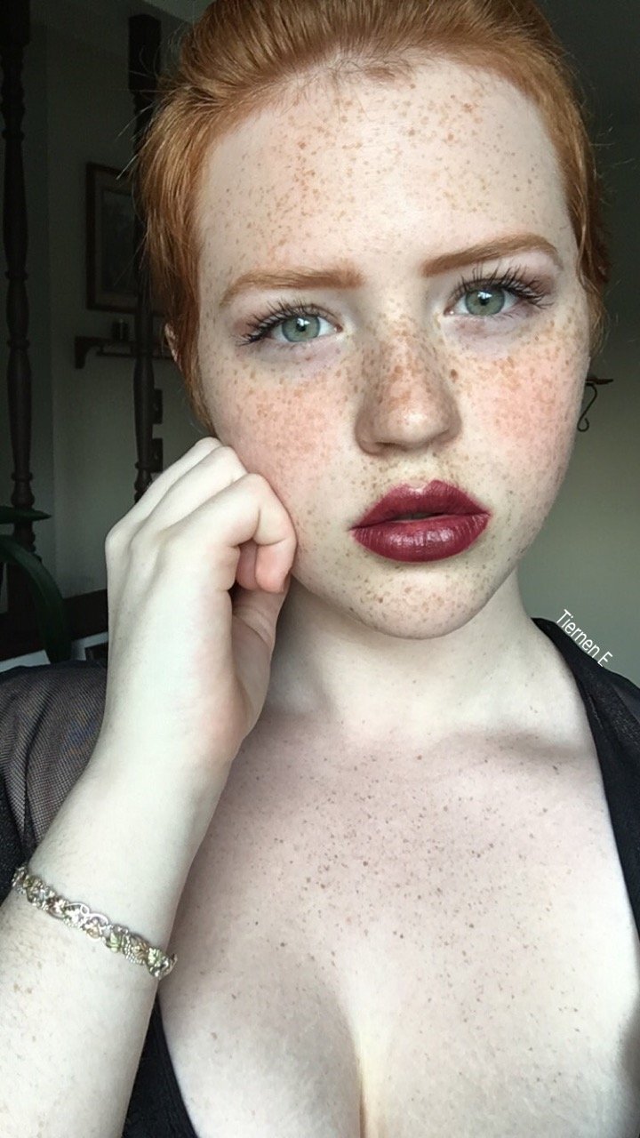 Freckles on the chest