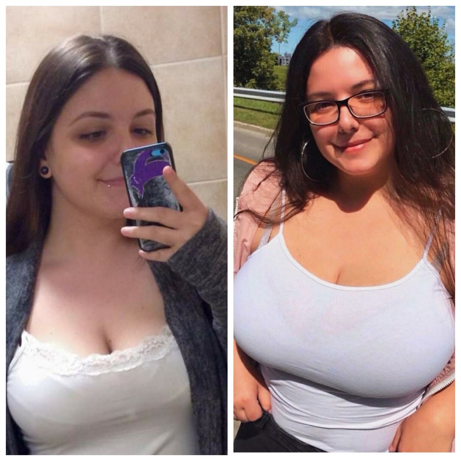 Anouk ddlgxo breast