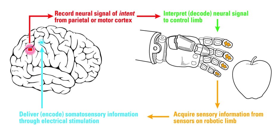 Artificial Neural Network