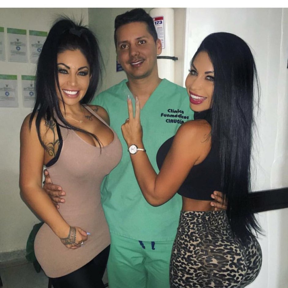 Bruna Twins before surgery