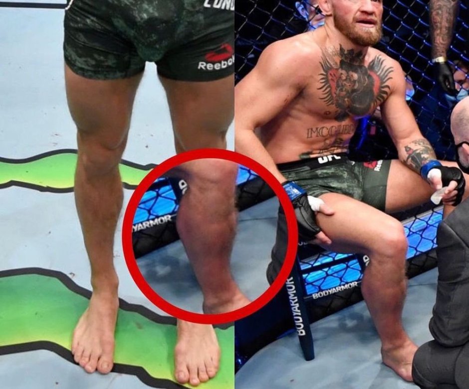 Conor McGregor Porrier