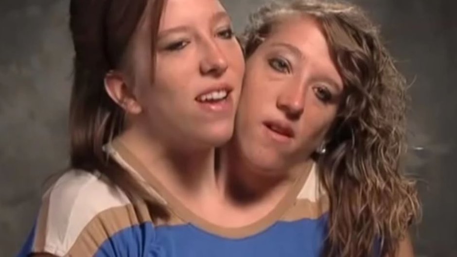 Sisters Abigail and Brittani Hensel