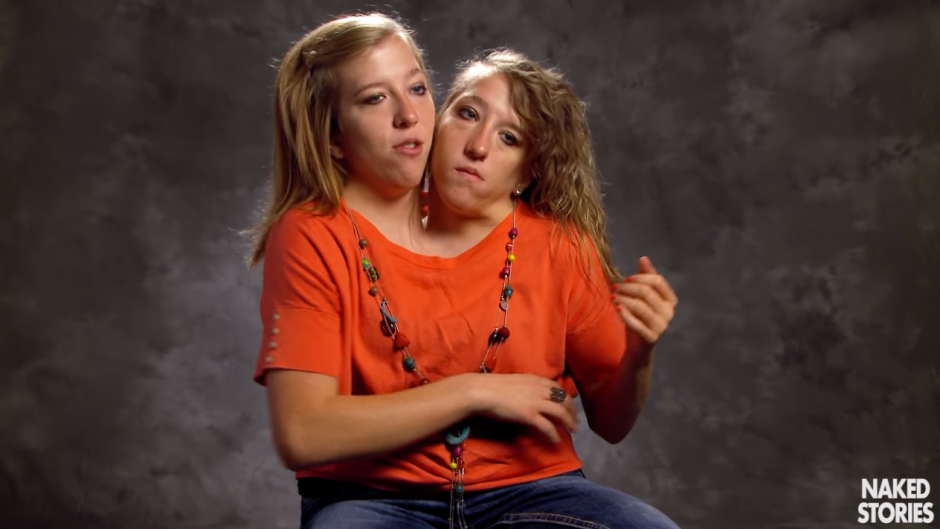 Abby and Brittani Hensel 2020