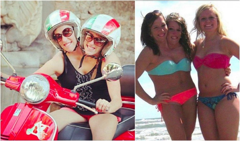 Hensel sisters in a swimsuit