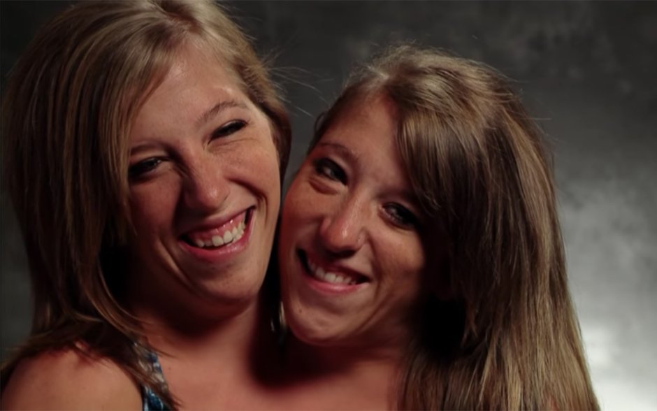Ebigail and Brittani Hensel 2021