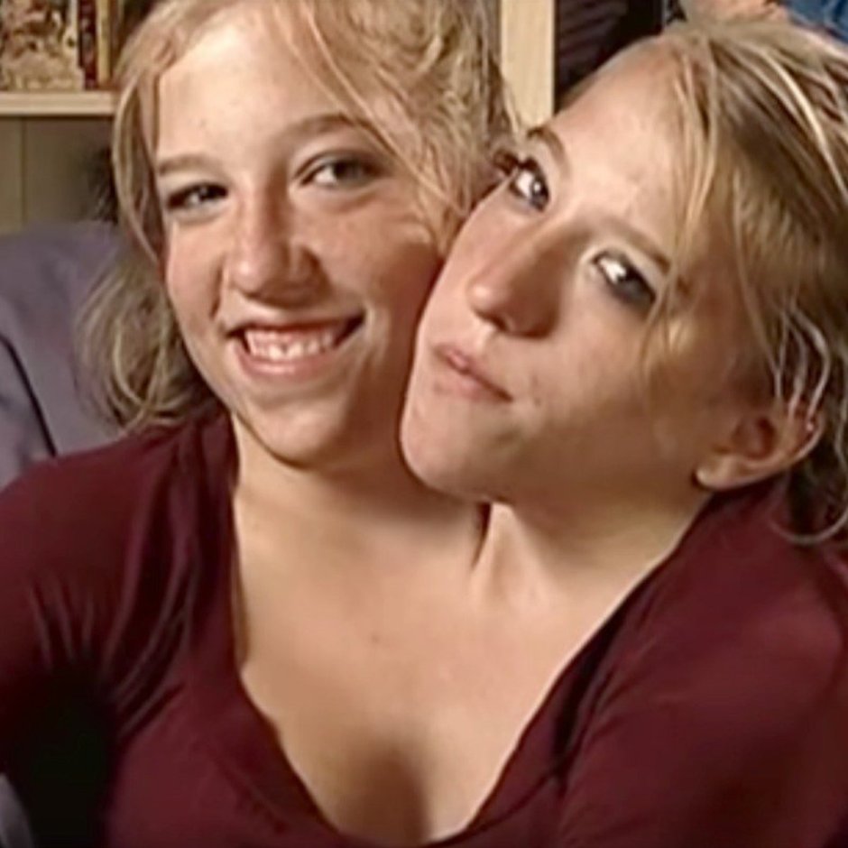 Abby and Brittani Hensel 2021