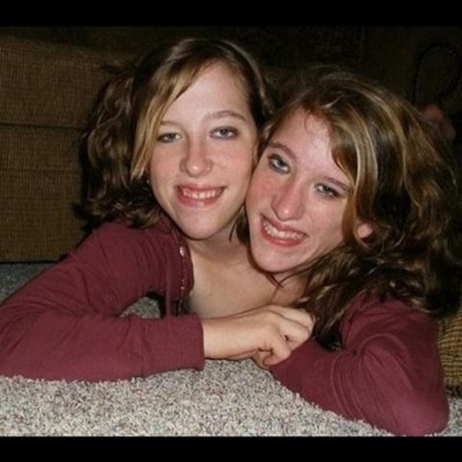 Sisters Abigail and Brittani Hensel