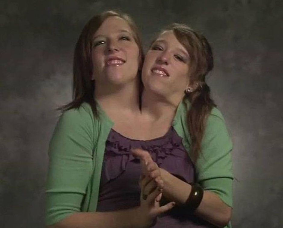Ebigail and Britain Hensel