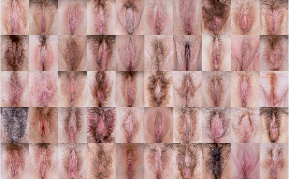 Vulva covered with hair