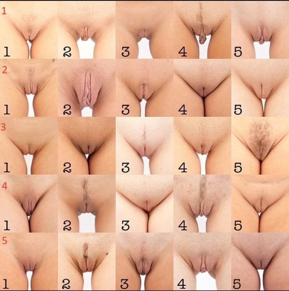High location of the vagina
