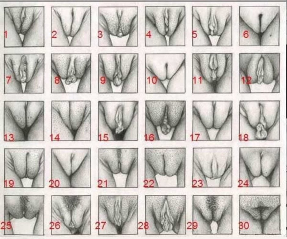 Forms of female genitals
