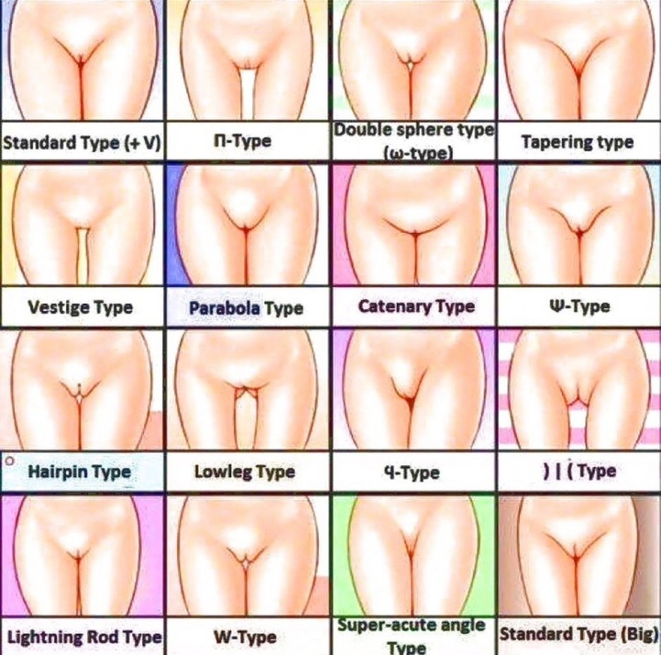 Forms of female vagina