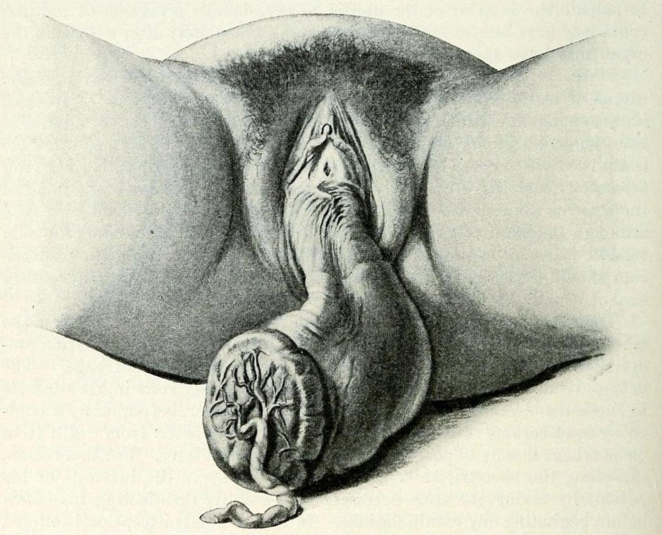 Anatomy of the female vagina