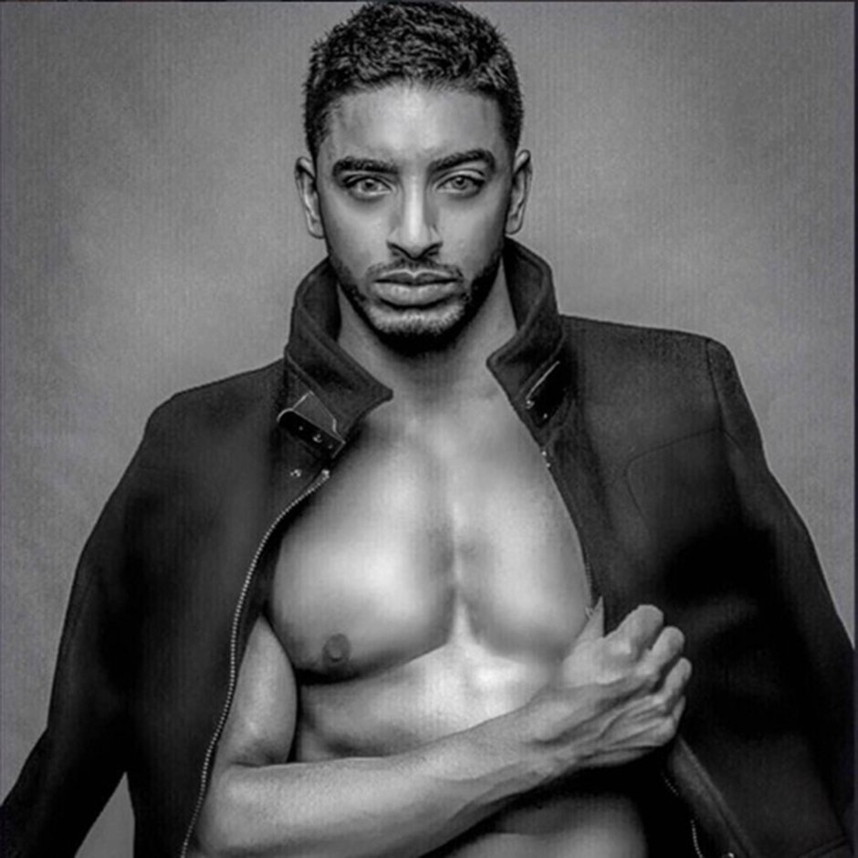 Laith Ashley model before surgery
