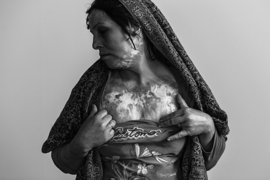 Naked women of Afghanistan