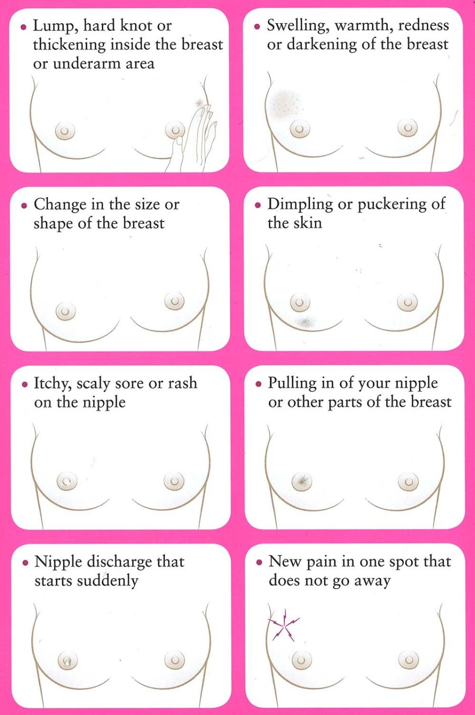 Breast translation