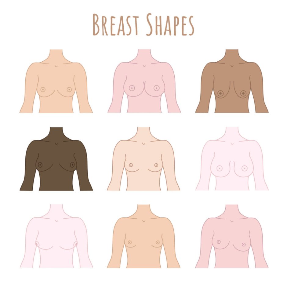 Breast types