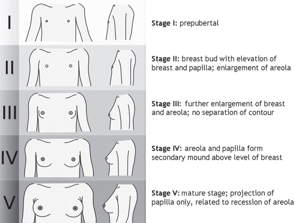 BREAST SIZE Progression