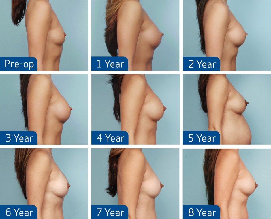 Naked chest of all sizes