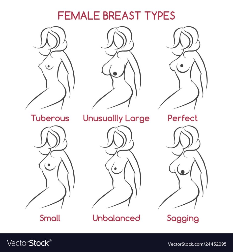 Varieties of female breast