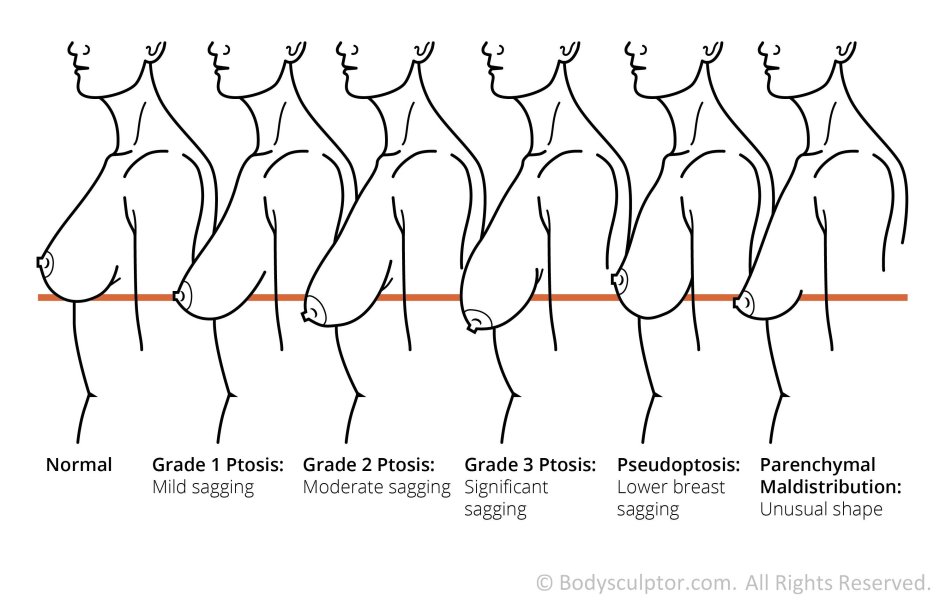 Breasts in different angles