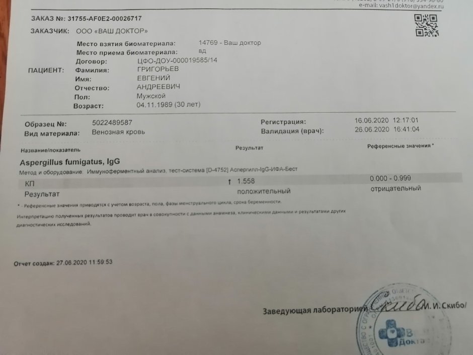 The result of the analysis for antibodies