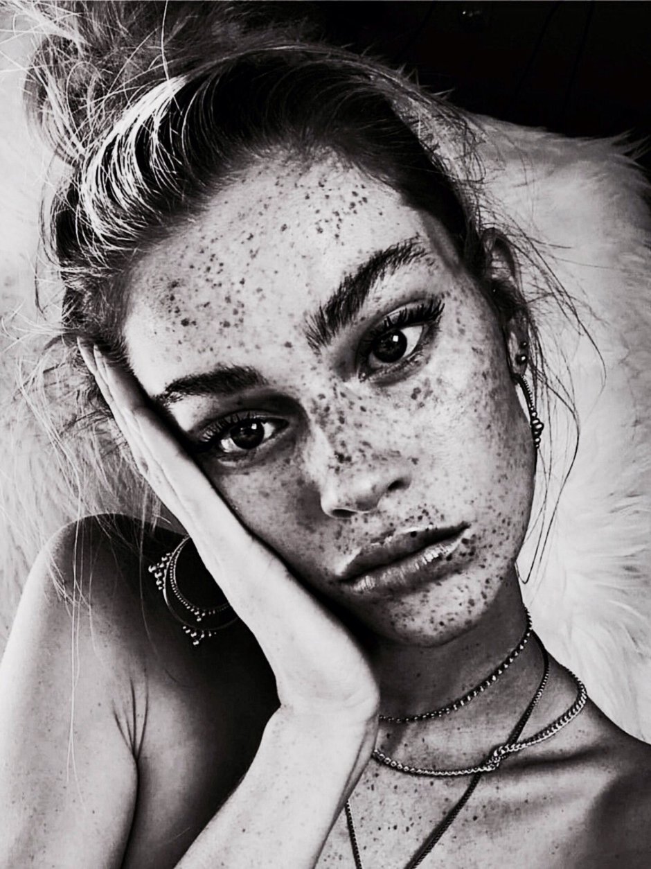 Highlighting girls with freckles