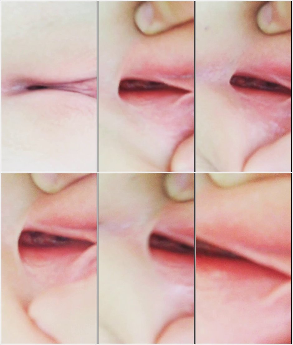 Girl's labia