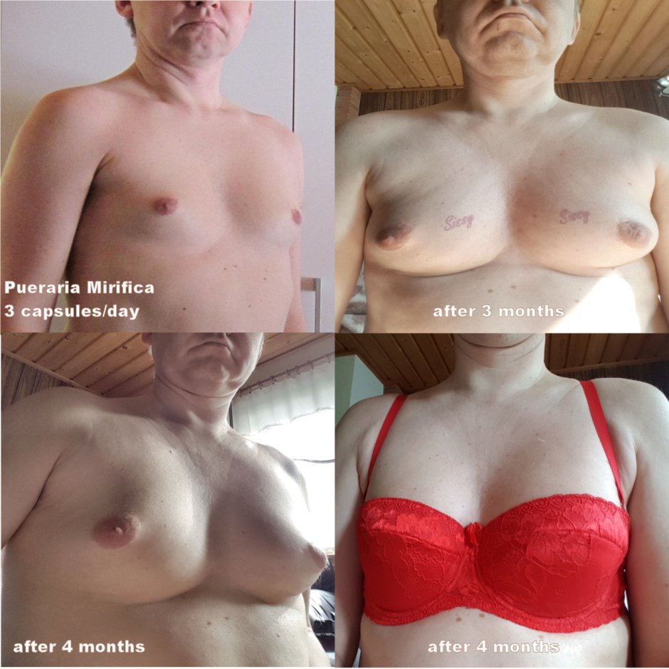 Transvestite with a vagina overhead