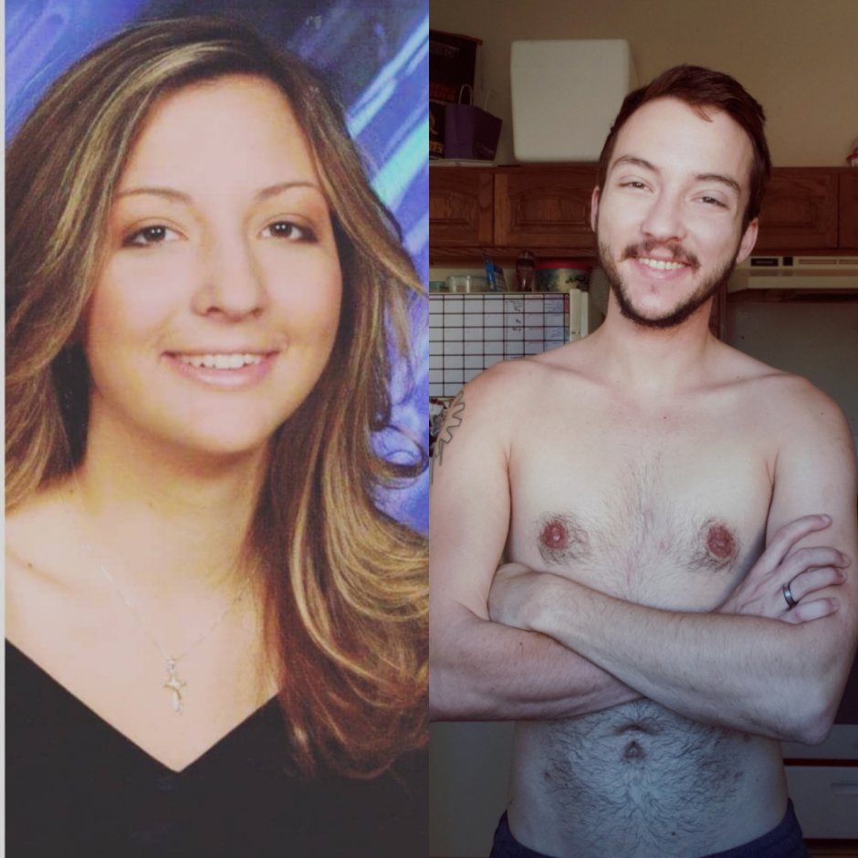 Transvestite genitals