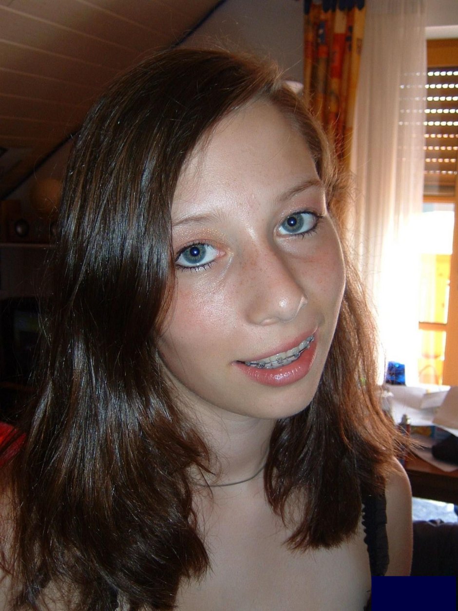 TYFTT BRACES