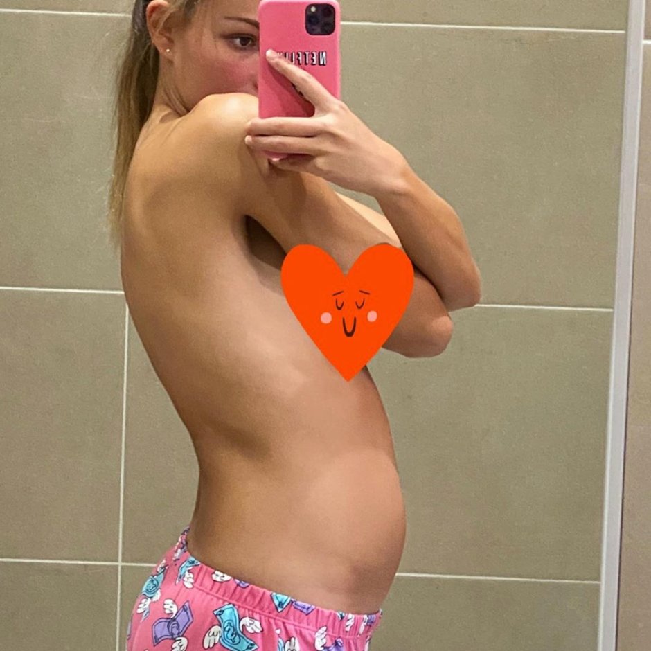 Erica McDermatot Sexy