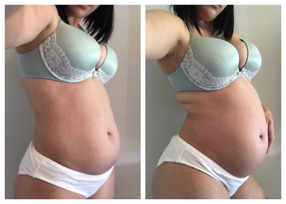 Vore Big Belly Staffing Staffing
