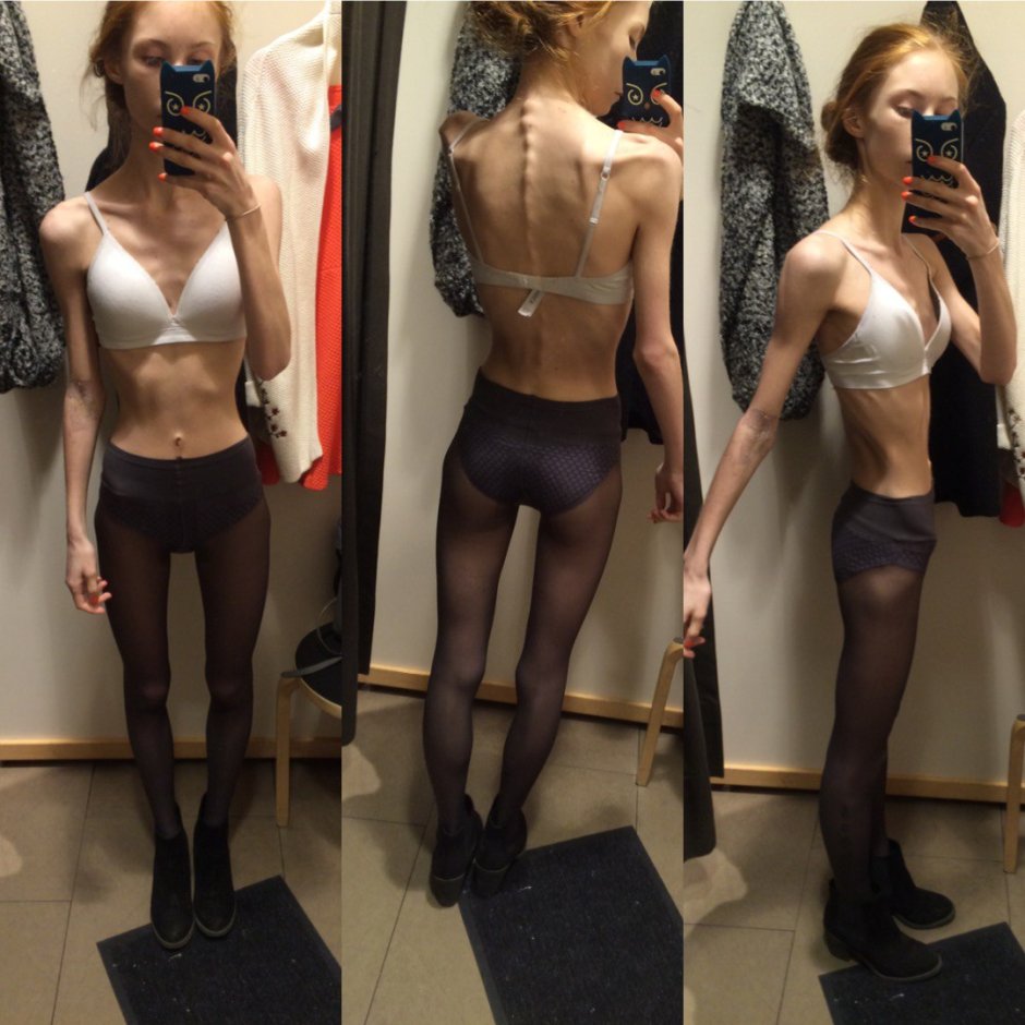 A little thin girl