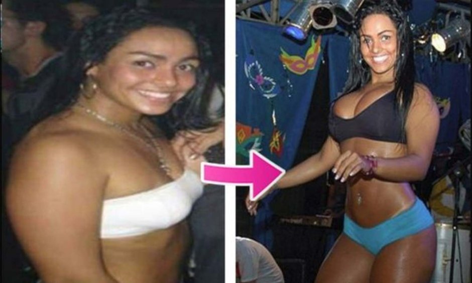 Andresta Soarez Tits