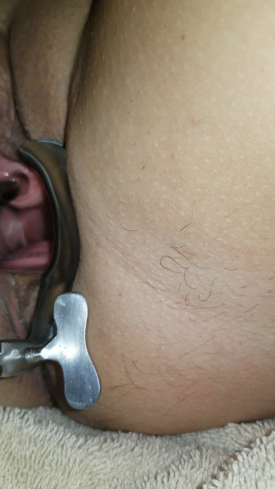 Girl Pee Hole Insertion Mobile Sex HQ Pics