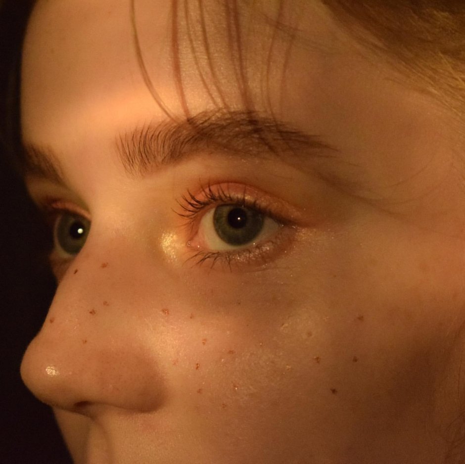 The Lower Age halazion in a child