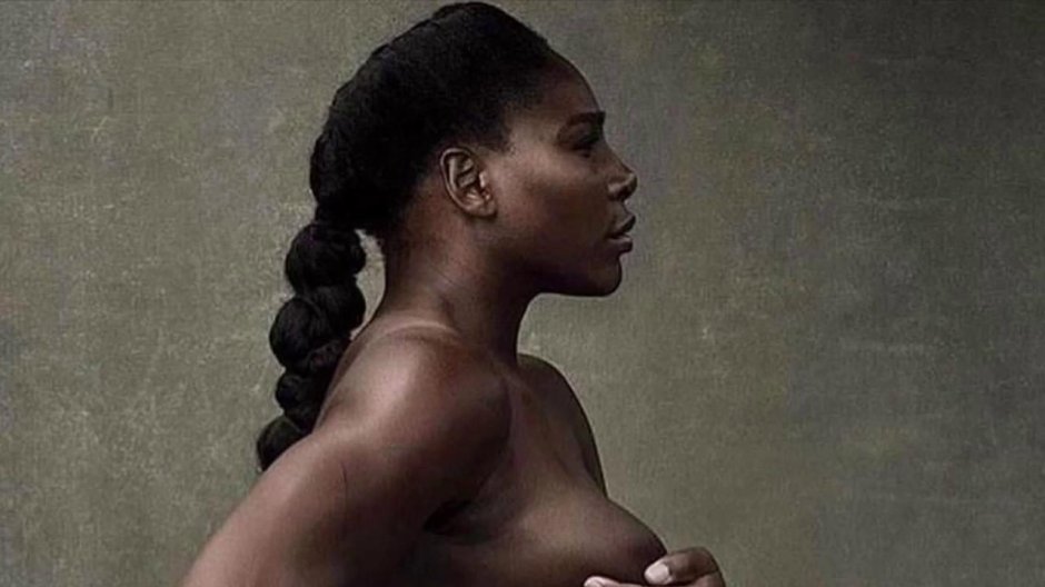 Serena Williams was exposed