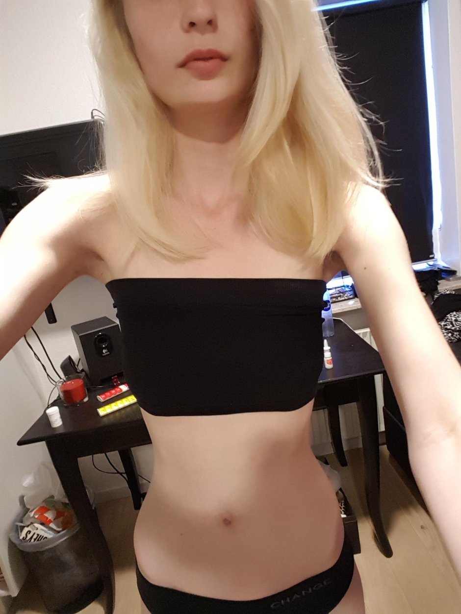 Anorexica with huge breasts