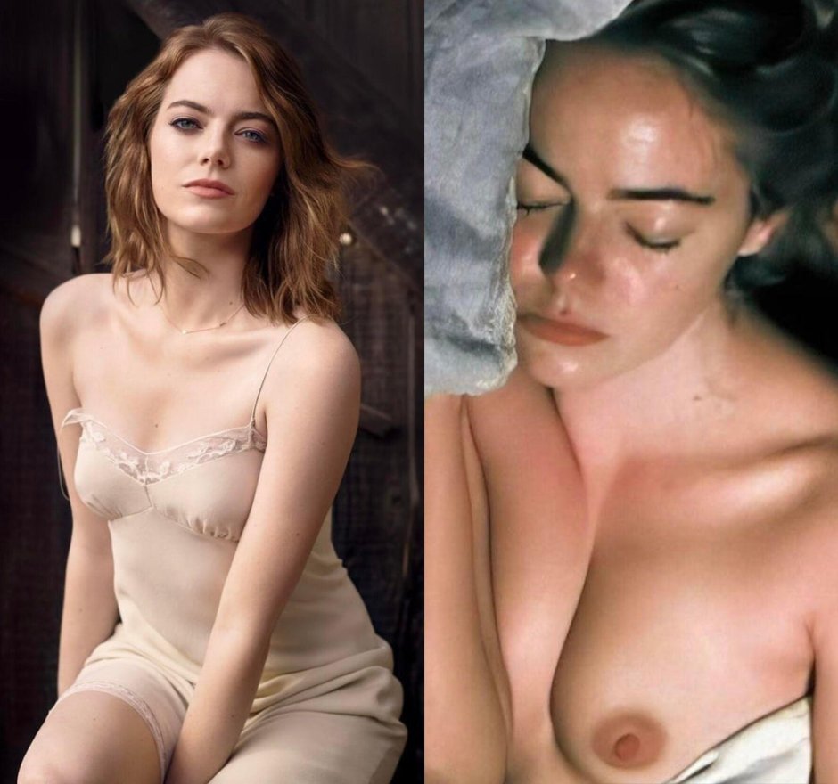 Emma Stone Naked Tits