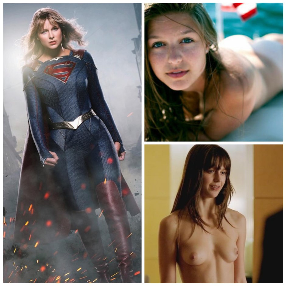 Melissa Benoist Hot