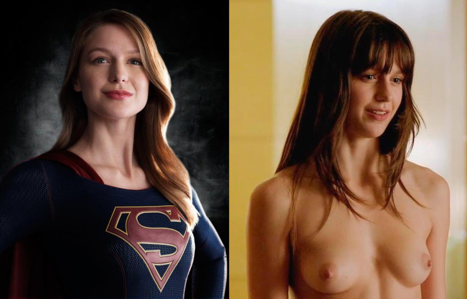 Melissa Benoist Supergers