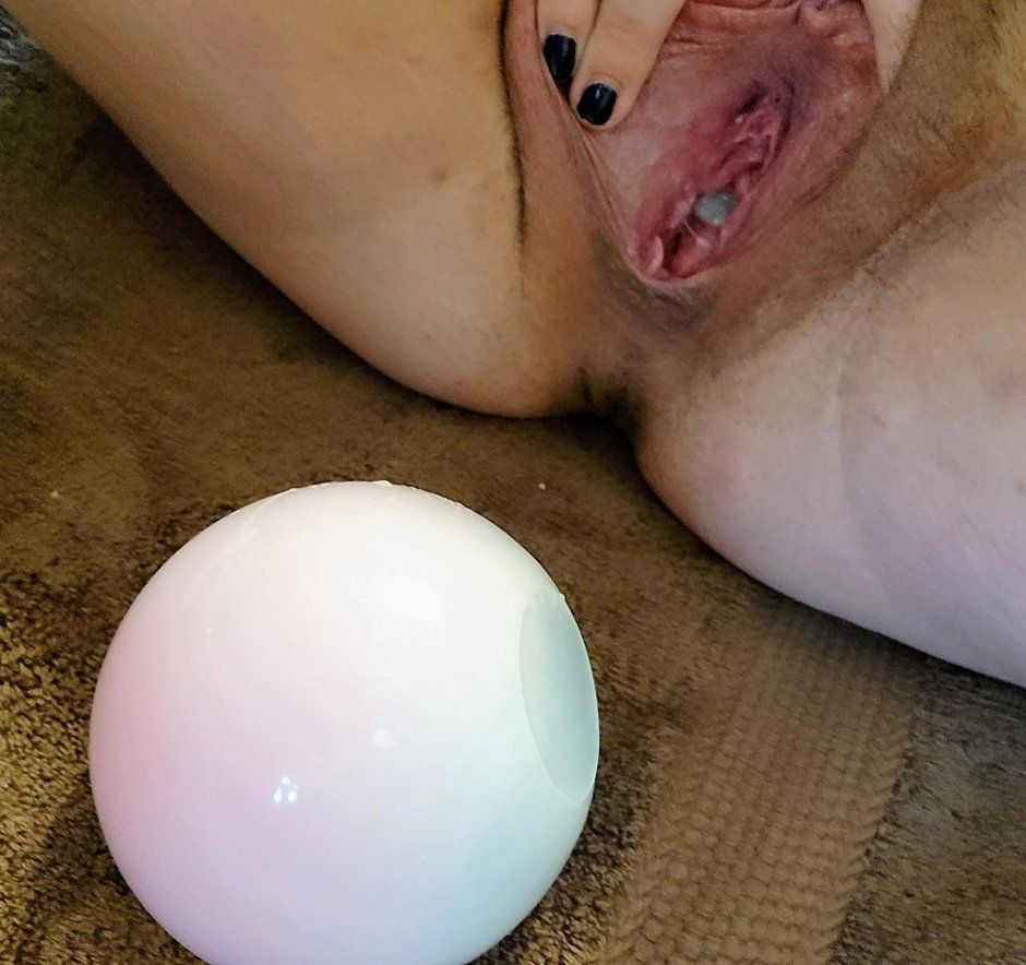 Anal prolapse in shorts