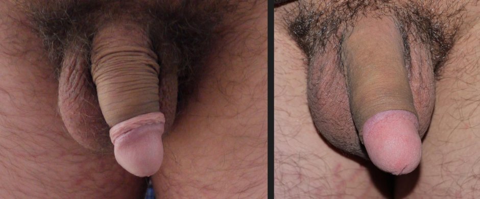 Cutting male penis