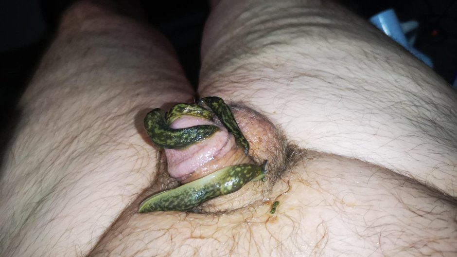 Formcophilia member of the leech