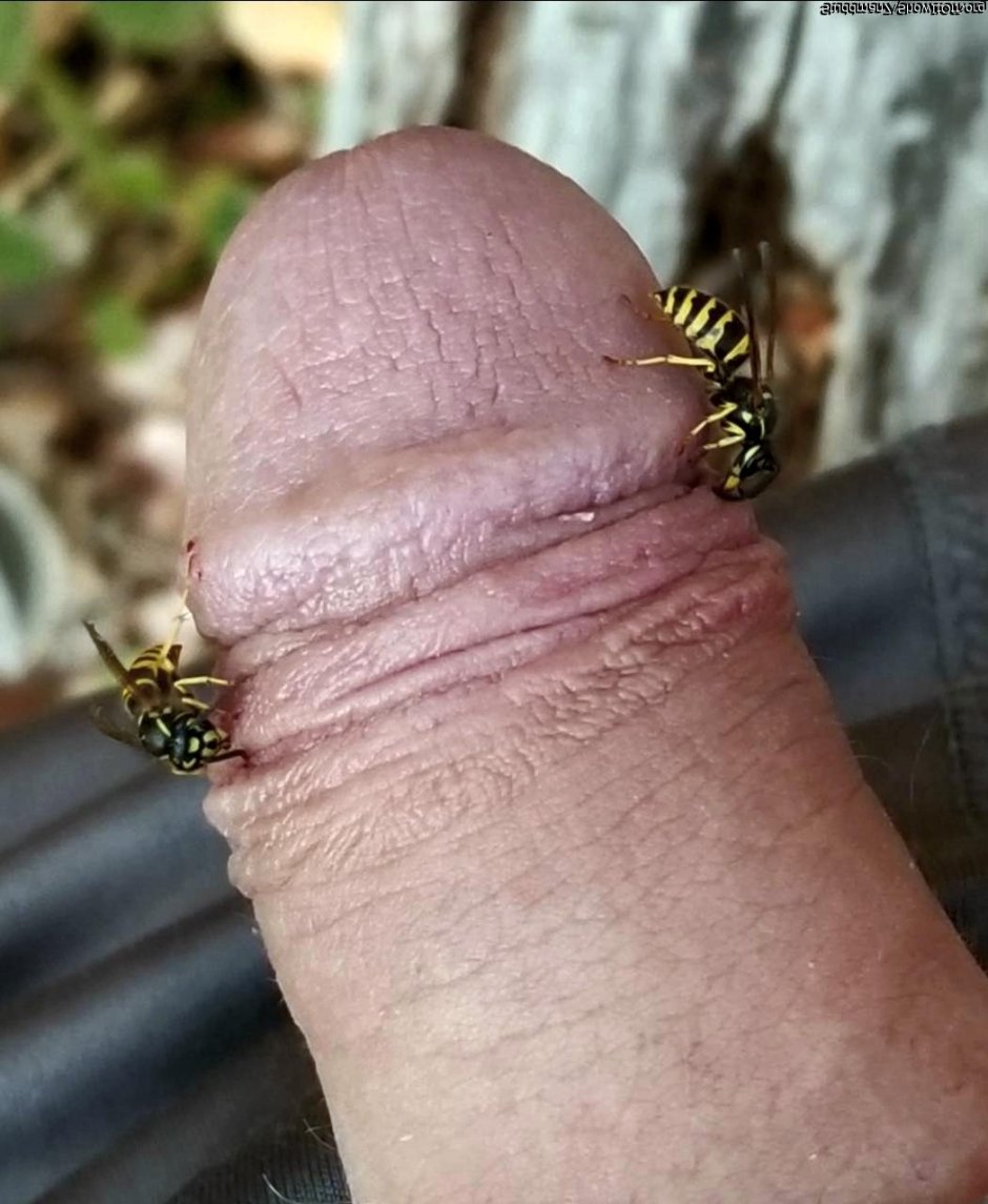 Formcophilia snails on a member