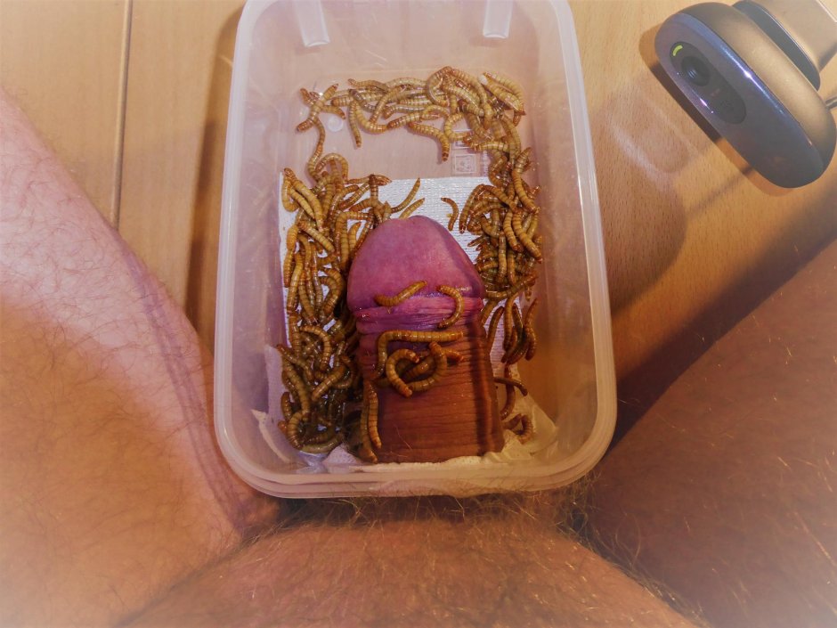 Formcophilia leeches in the urethra