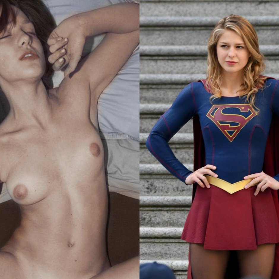 Melissa Benoist superherl naked