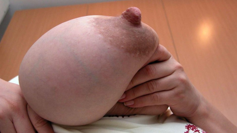 Huge dairy breasts